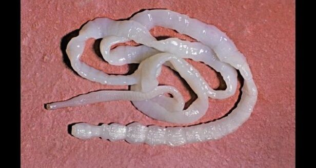 human tapeworm in the body