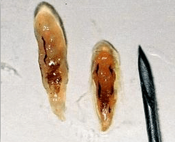 Opistorchi